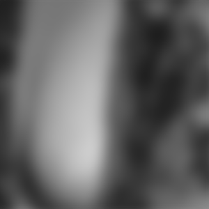 rencontre-Beurette-Dunkerque